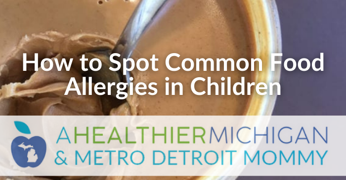How to Spot Common Food Allergies in Children