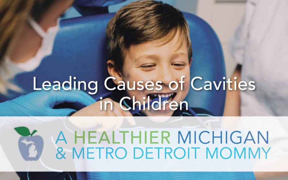 Leading Causes of Cavities in Children 13 MDM cavities scaled