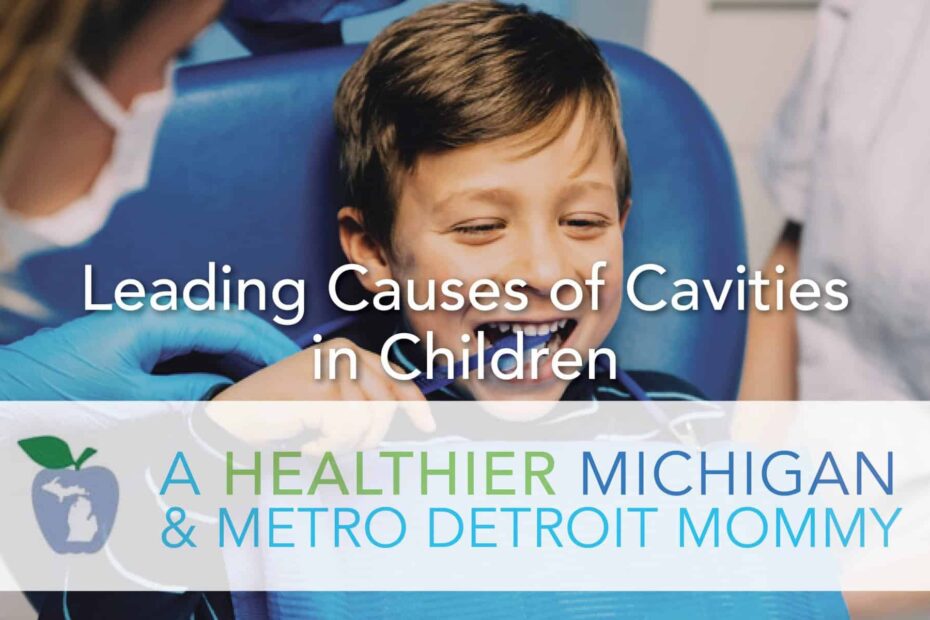 Leading Causes of Cavities in Children 29 MDM cavities scaled